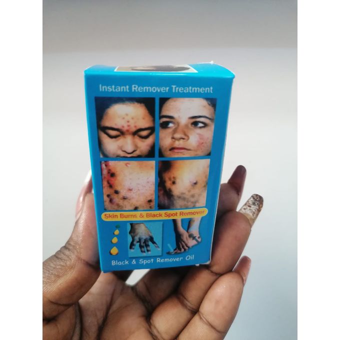 Clarins Skin Burns & Black Spot Remover Cream