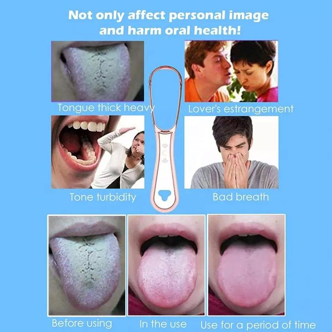 Tongue Scraper – 100% BPA Free Effective Tongue Brush Tool for Bad Breath Treatment