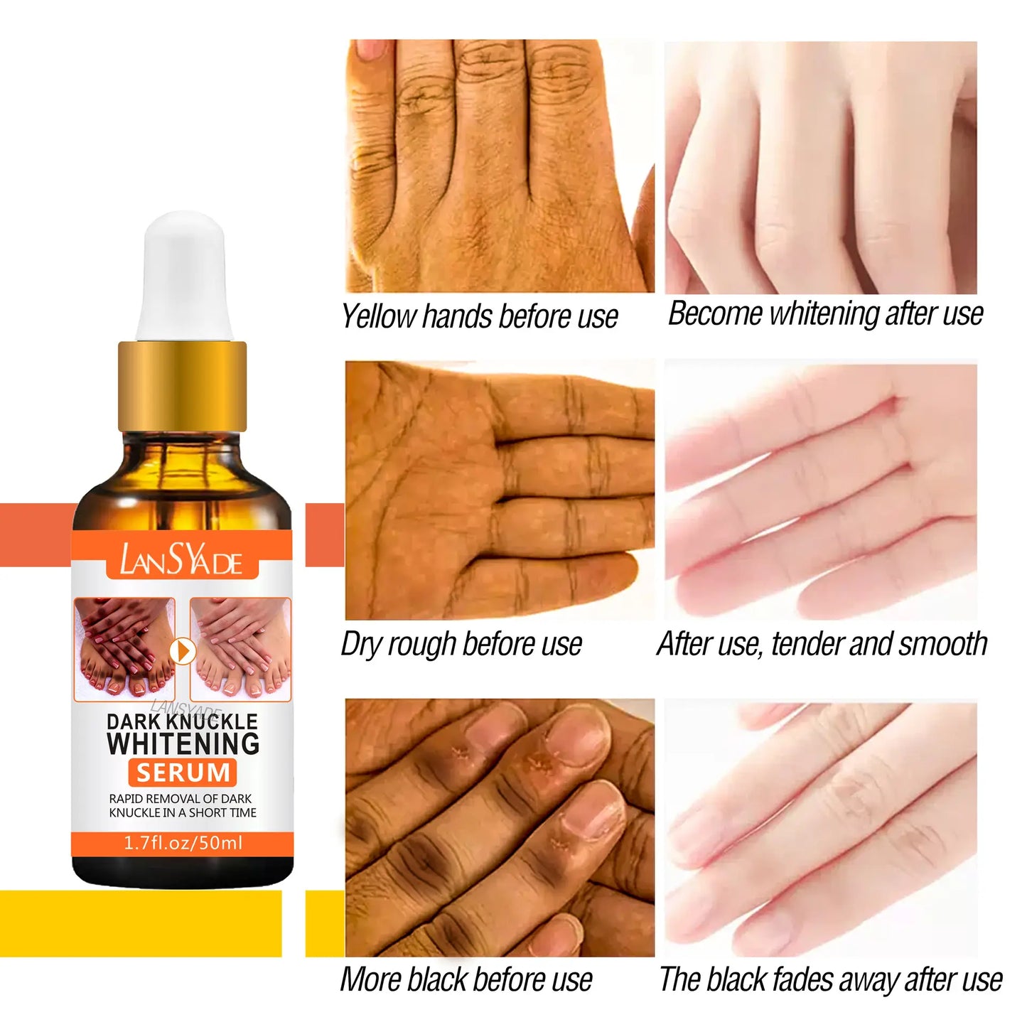 LansYade Dark Knuckle Whitening Serum (50ml)