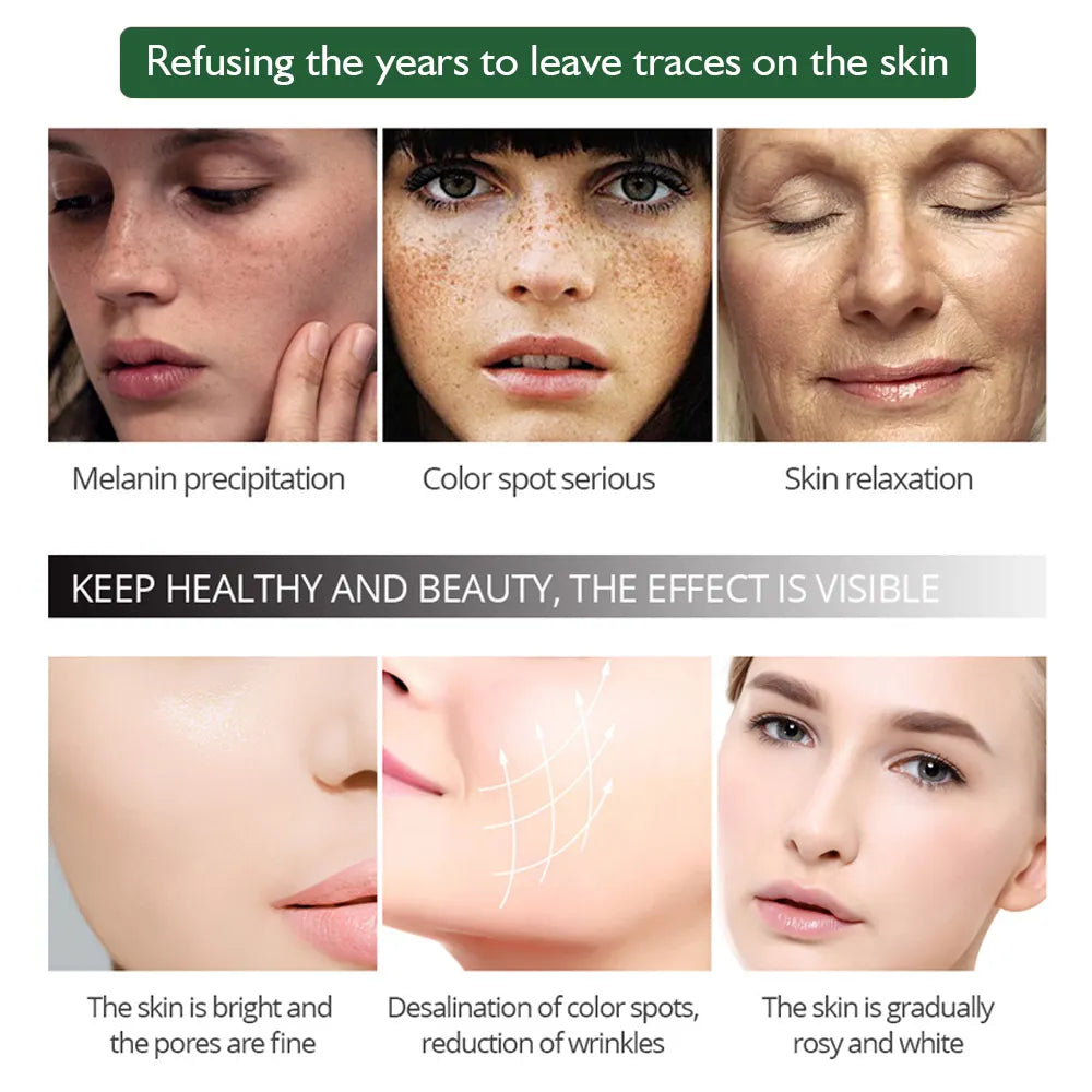 Aichun Beauty Anti-Freckle Whitening Facial Serum (30ml)