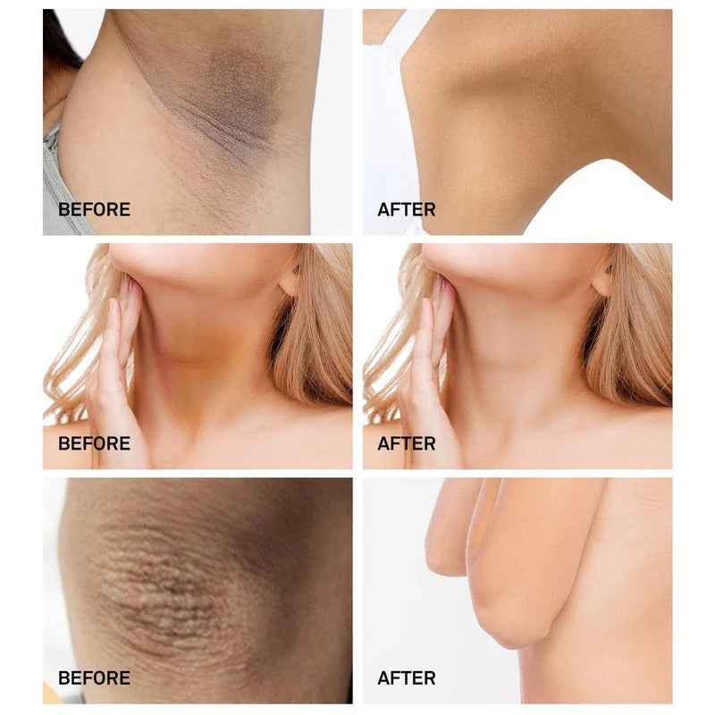 OUHOE 3‑Days Whitening Cream (Face & Body, 20 g)