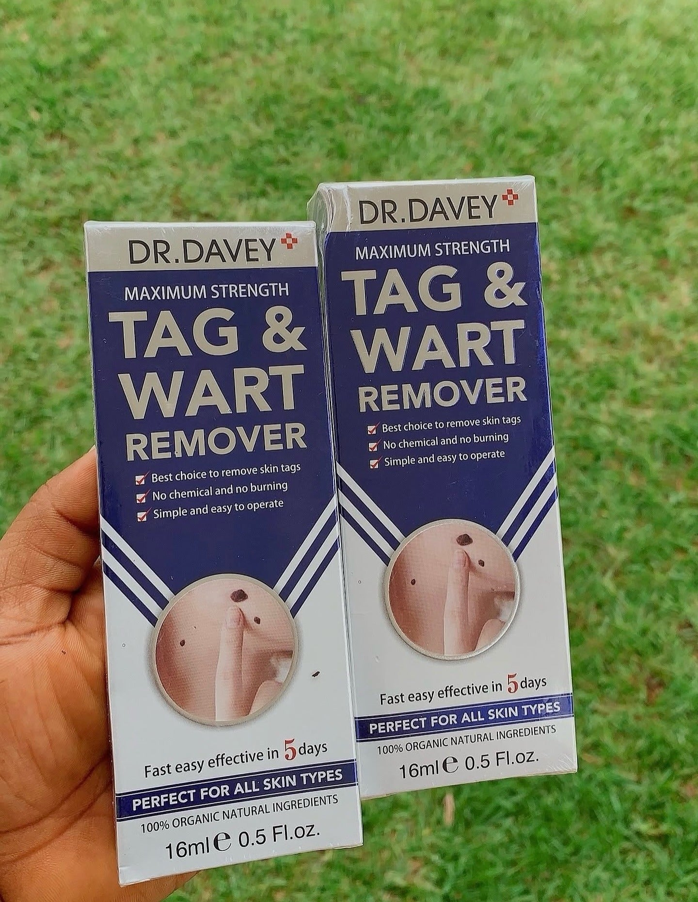 Dr Davey Maximum Strength Tag & Wart Remover | Dries Out & Drops Off Naturally in 10 Days | Discreet Delivery Countrywide