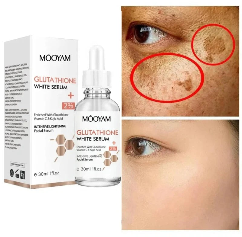 MOOYAM Glutathione Whitening Serum (30ml)