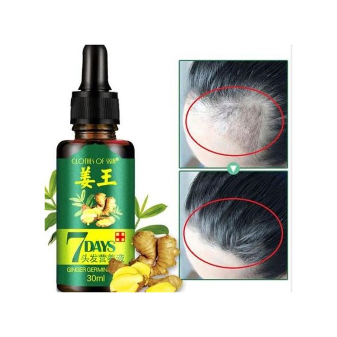 Clothes Of Skin 7Days Ginger Germinal Essential Hair Growth Oil For Hair Loss/Hair Treatment-For Both Men&Women30ml