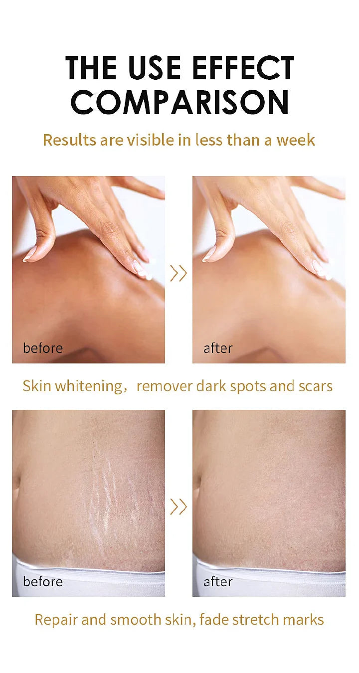 DR.MEINAIER Peeling Oil Whitening Peeling Oil Lighten Elbows Knees Hands Melanin Even Skin Tone and Whiten Skin