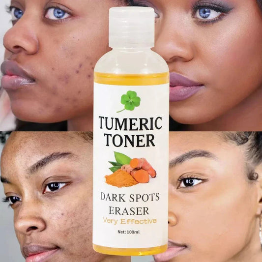 MOOYAM Quick Dark Spots Corrector Serum Tumeric Toner Acne Remover Fade Dark Spots Eraser Skin Care Serum- MOOYAM -