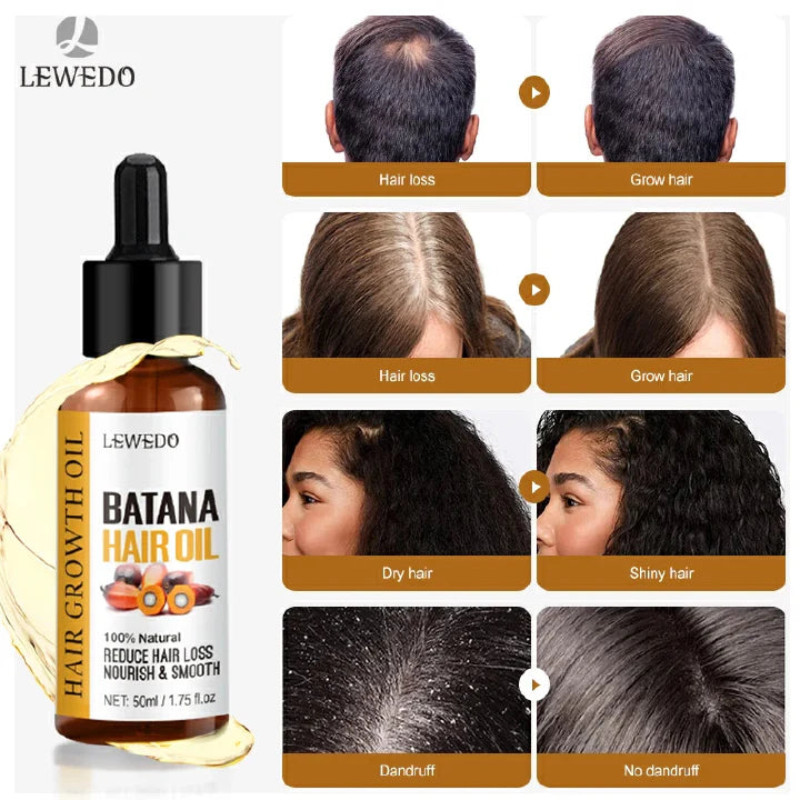 🔥 LIMITED DEAL — Lewedo Natural Batana Oil | Stimulates Hair Growth + Reduces Breakage + Deep Scalp Nourishment | KSh 2,500