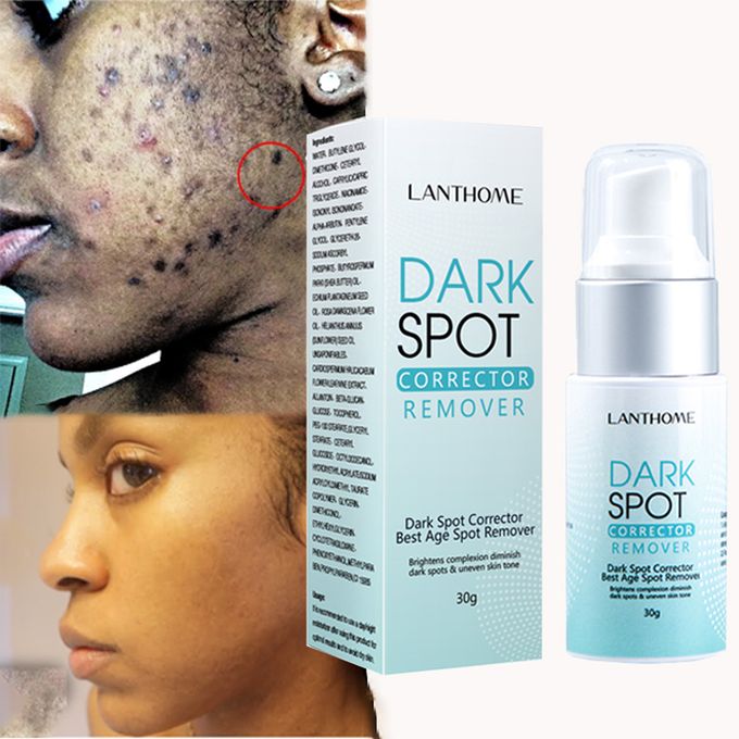 Lanthome Dark Spot Corrector