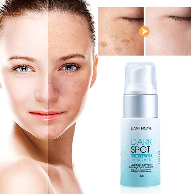 Lanthome Dark Spot Corrector