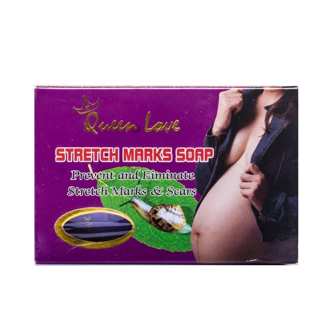 Queen Love Stretch Marks Soap Prevents & Eliminates Stretch Marks & Scars-135G