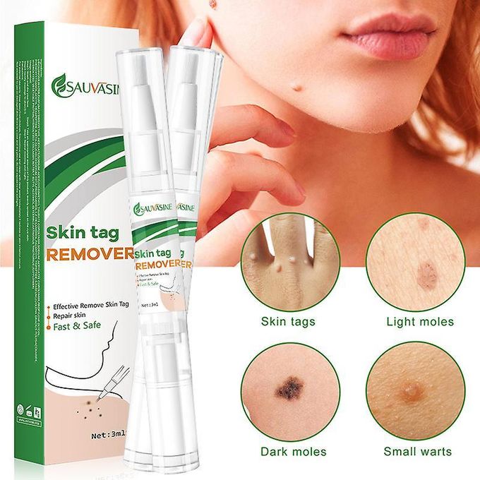 Sauvasine Skin Tag Remover & Wart Remover Lotion