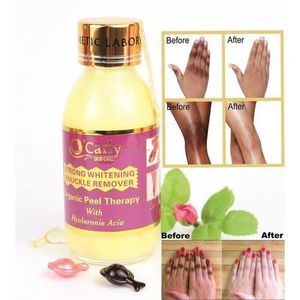 O'Carly Knuckle Remover Cream