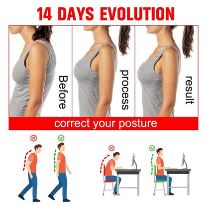 Adjustable Back Posture Corrector – Shoulder Support Belt