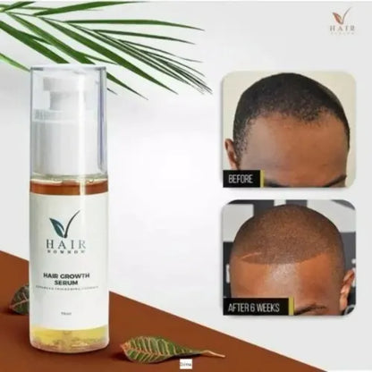 Hair Now Now Hair Growth Oil/Serum