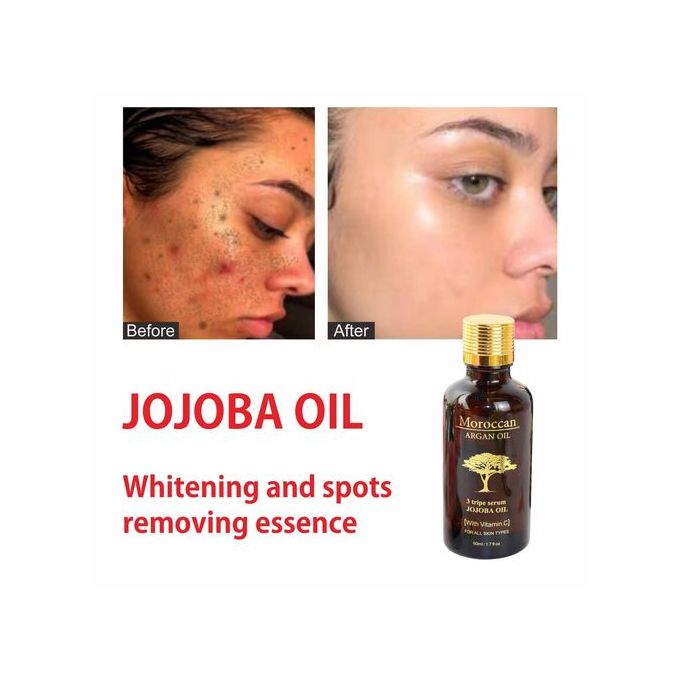 Moroccan Argan Oil Anti Aging Whitening Vitamin C Jojoba Oil Serum