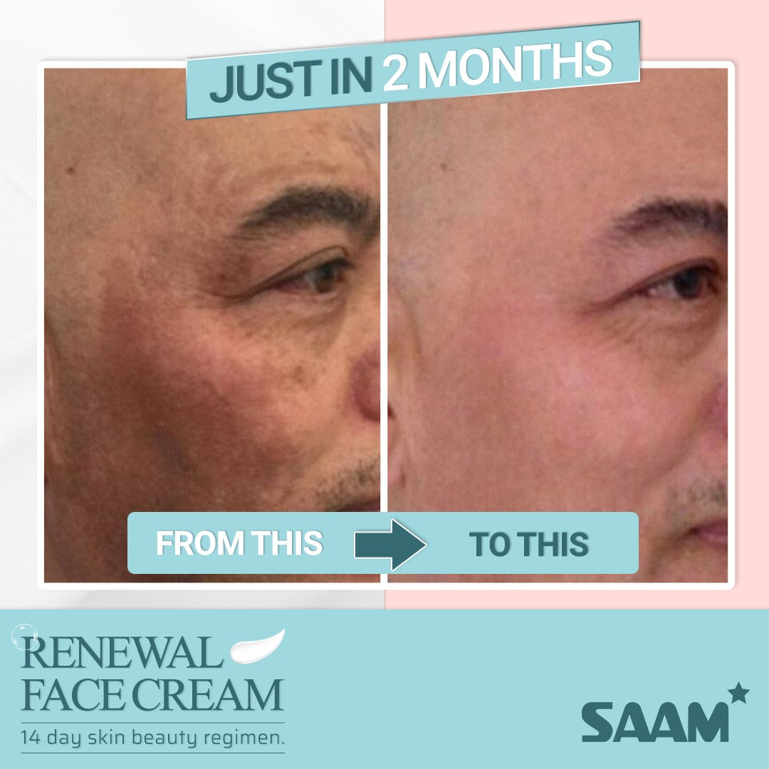 🔥ORIGINAL Saam Renewal Face Cream with QR CODE , BUY 1 GET 1 EXTRA FREE 🔥