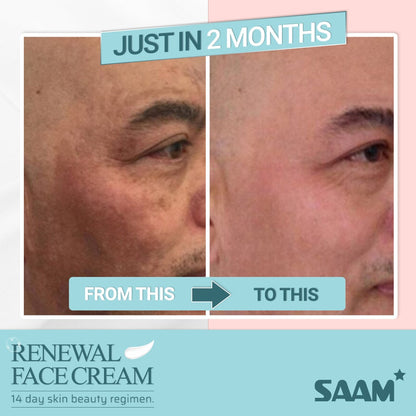 🔥ORIGINAL Saam Renewal Face Cream with QR CODE , BUY 1 GET 1 EXTRA FREE 🔥