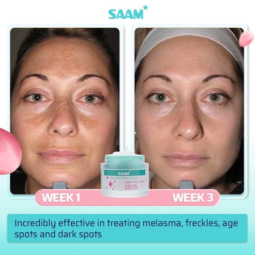 🔥 ORDER 1, WE SEND 2 — SAAM Renewal Face Cream | Anti-Ageing + Deep Hydration + Glowing Skin | KSh 4,500
