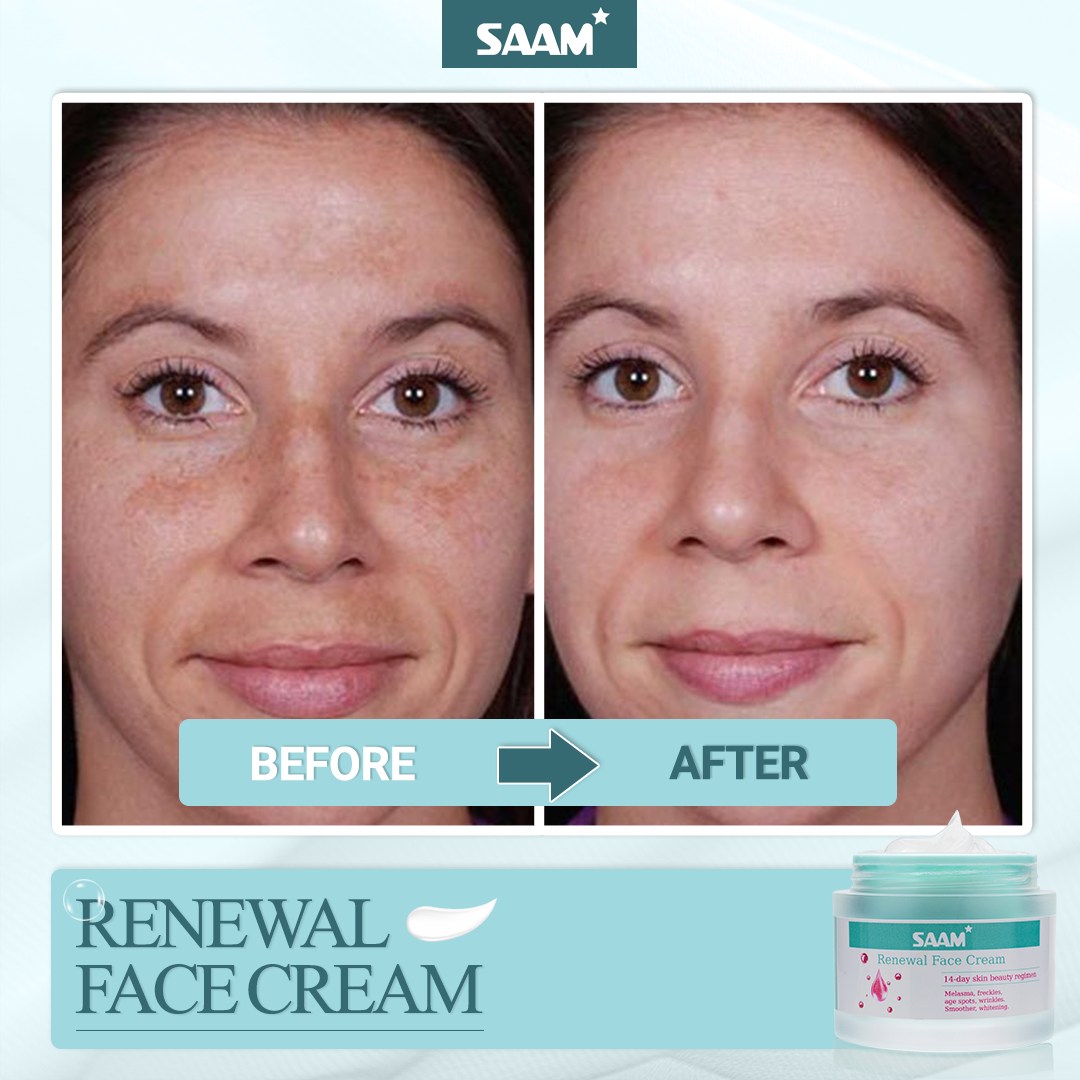 🔥 ORDER 1, WE SEND 2 — SAAM Renewal Face Cream | Anti-Ageing + Deep Hydration + Glowing Skin | KSh 4,500