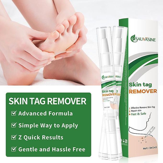 Sauvasine Skin Tag Remover & Wart Remover Lotion