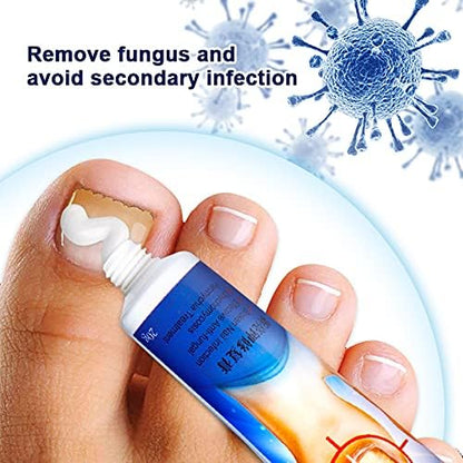 🔥 Sumifun Nail Fungus Treatment Cream – Fast Relief for Nail Fungus, Discoloration & Thick Nails | Restore Healthy Nails Naturally