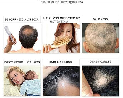 Disaar Hair Growth In Baldness Essential Oil For Anti Hair Loss-30g