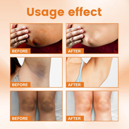 🔥 LIMITED DEAL — SADOER Vitamin C Whitening Cream | Brighten + Fade Dark Spots + Anti-Ageing + Hydrate | KSh 1,600