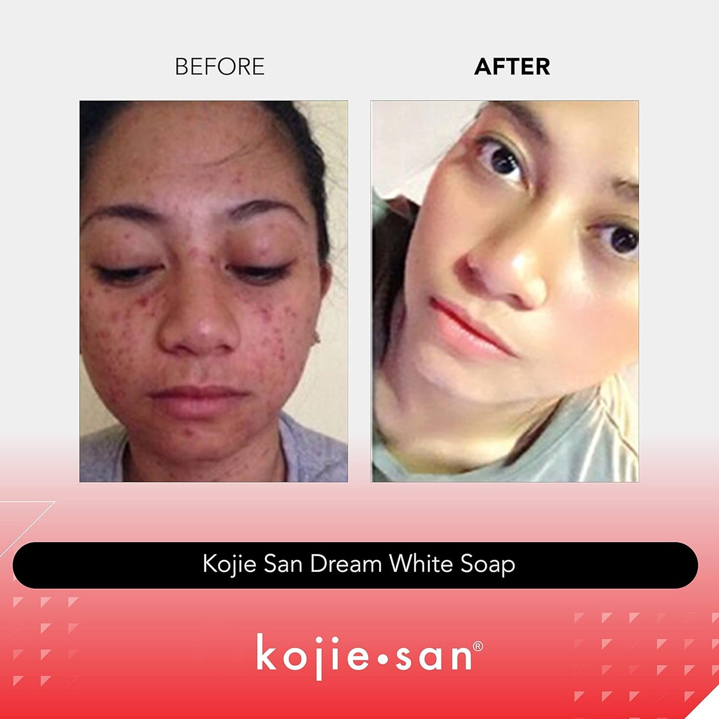 Kojie San Dreamwhite Anti-Aging Soap