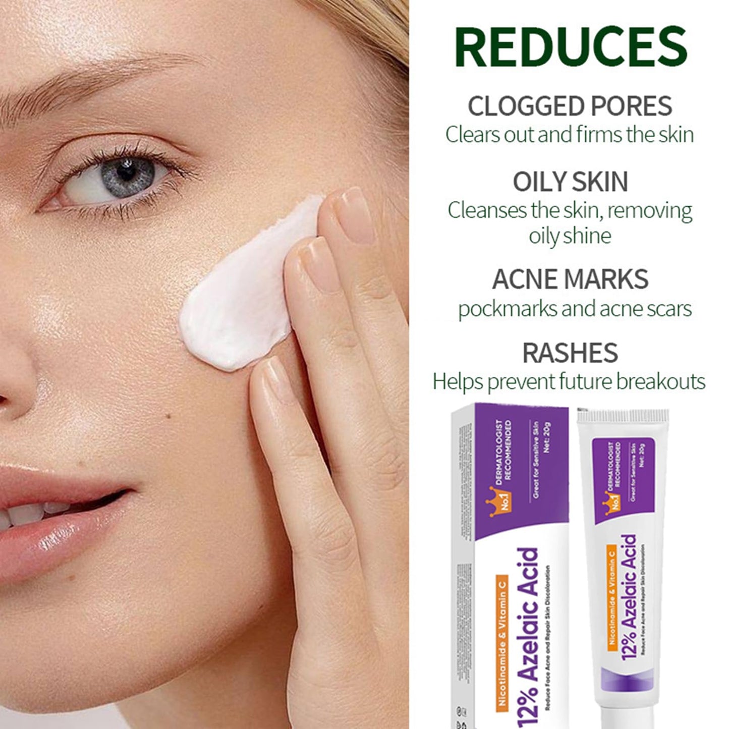 Sauvasine Azelaic Acid 12% Facial Cream with Hyaluronic Acid & Niacinamide – Fade Dark Spots, Acne & Redness A