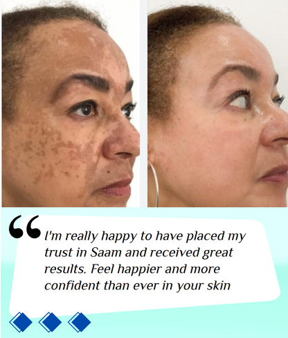 🔥ORIGINAL Saam Renewal Face Cream with QR CODE , BUY 1 GET 1 EXTRA FREE 🔥
