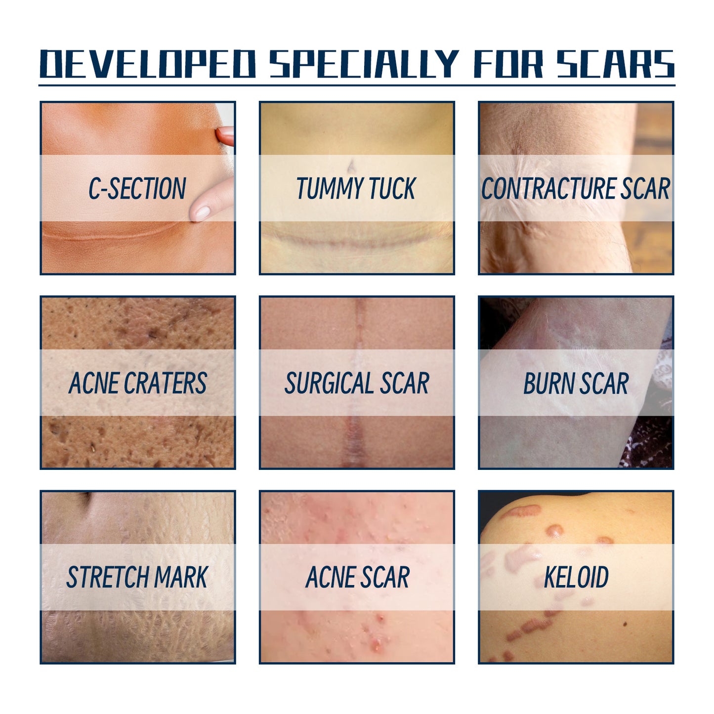 West & Month High Grade Formula Scar Gel