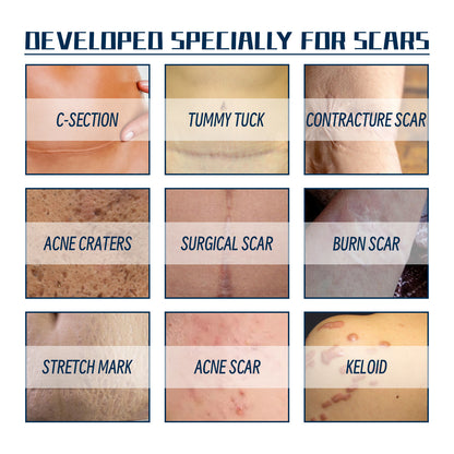 West & Month High Grade Formula Scar Gel