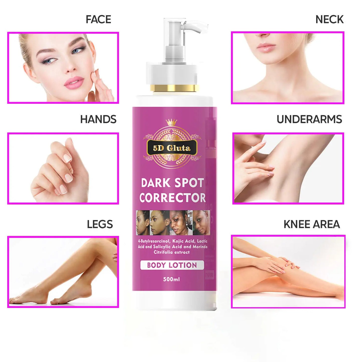 5D Gluta Dark Spot Repair Body Lotion (500ML)