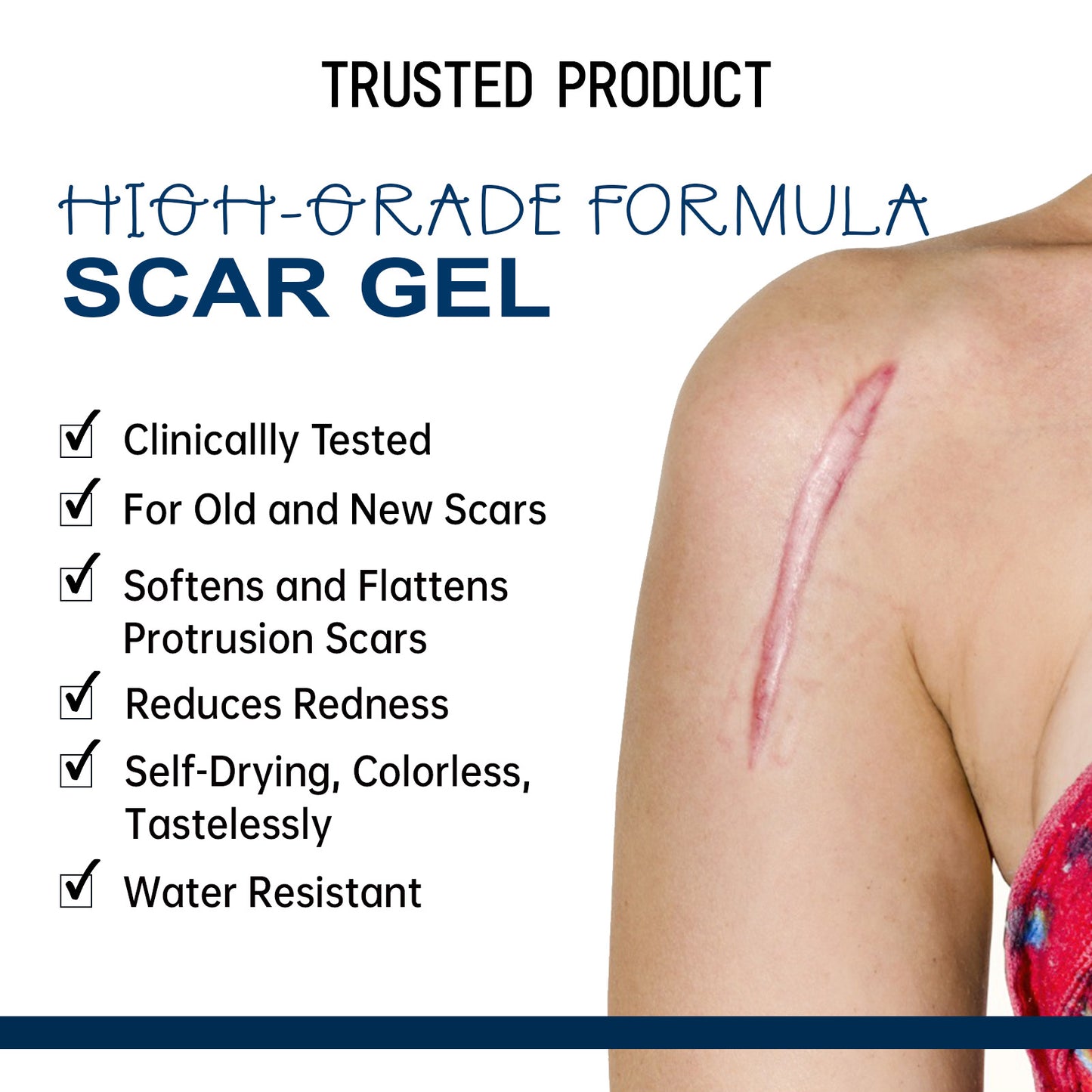 West & Month High Grade Formula Scar Gel