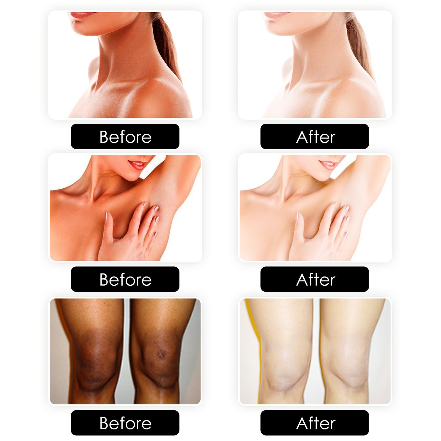 OUHOE Kojic Acid Soap