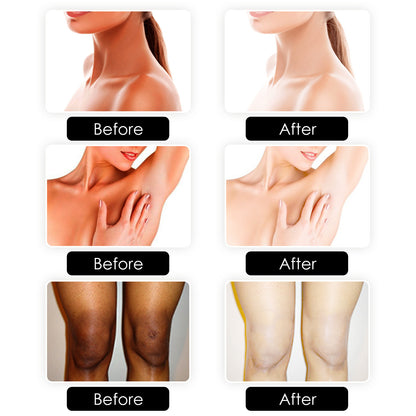 OUHOE Kojic Acid Soap