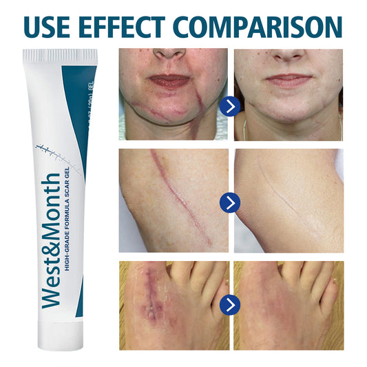 West & Month High Grade Formula Scar Gel