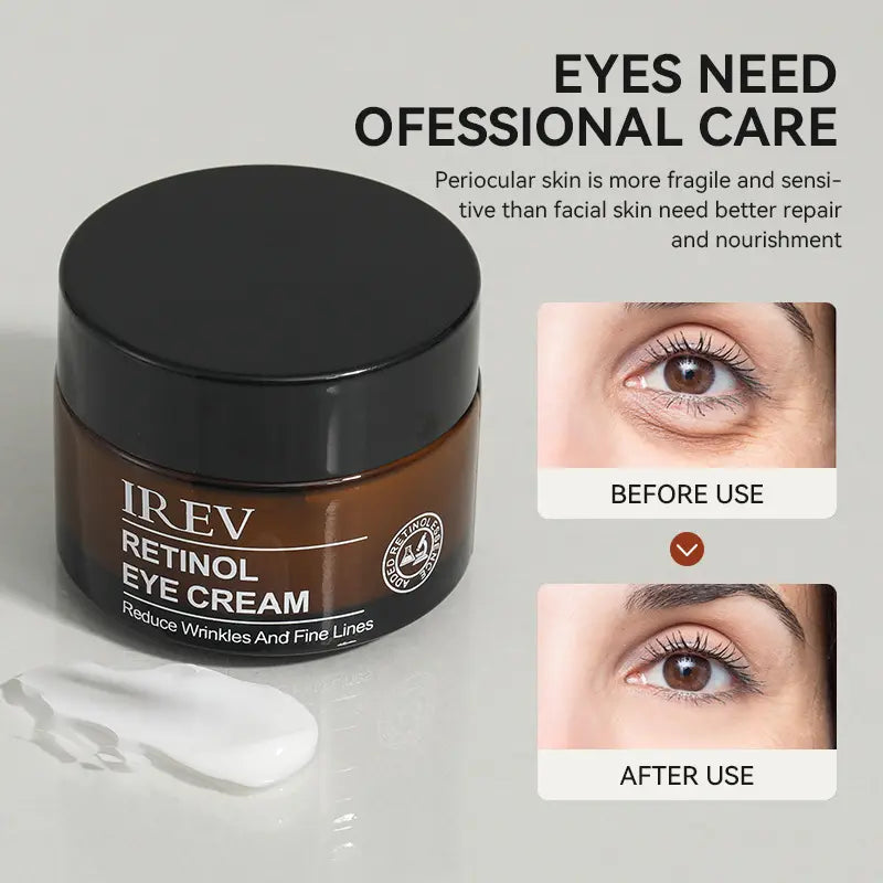 IREV Retinol Eye Cream