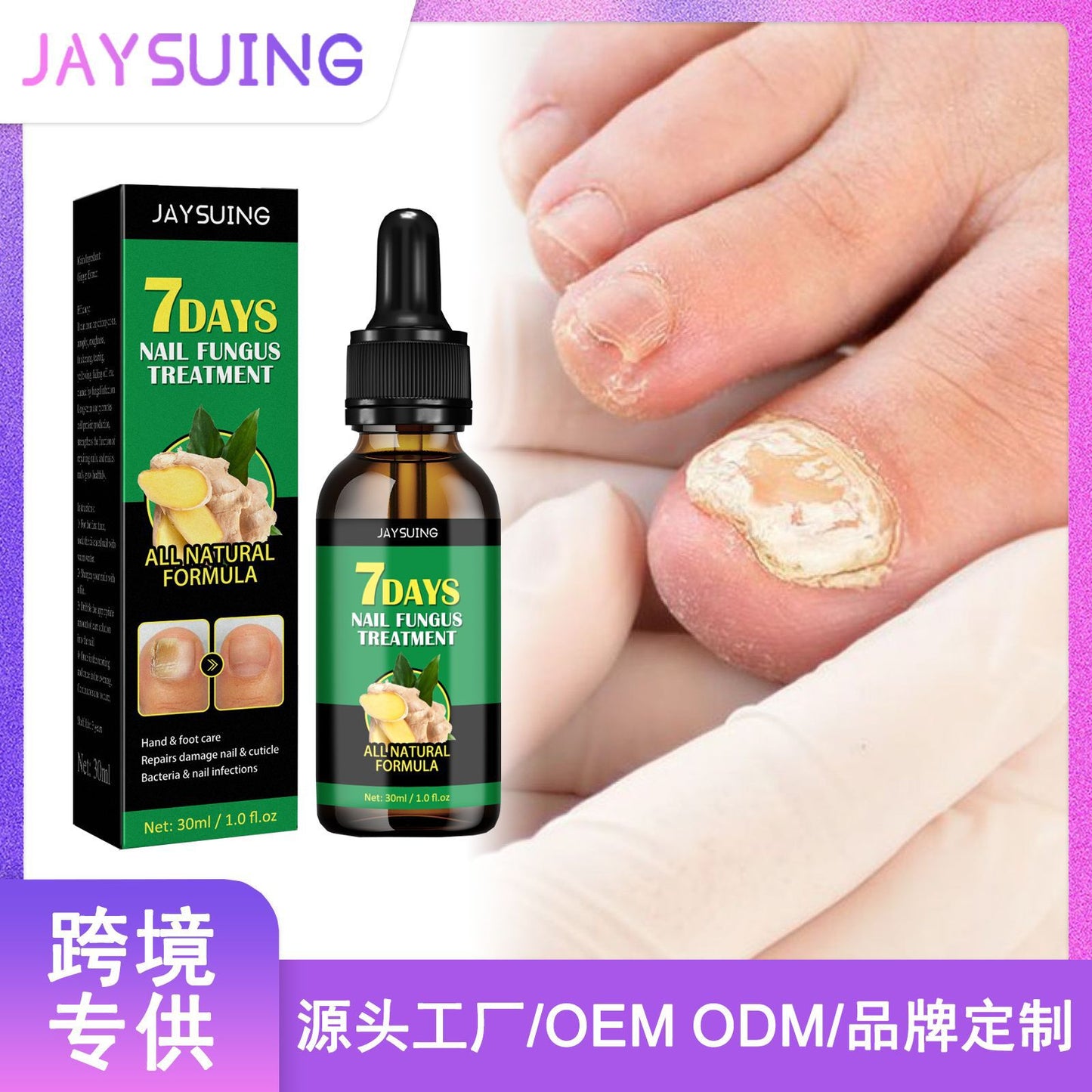 Jaysuing 7 Days Nail Fungus Treatment