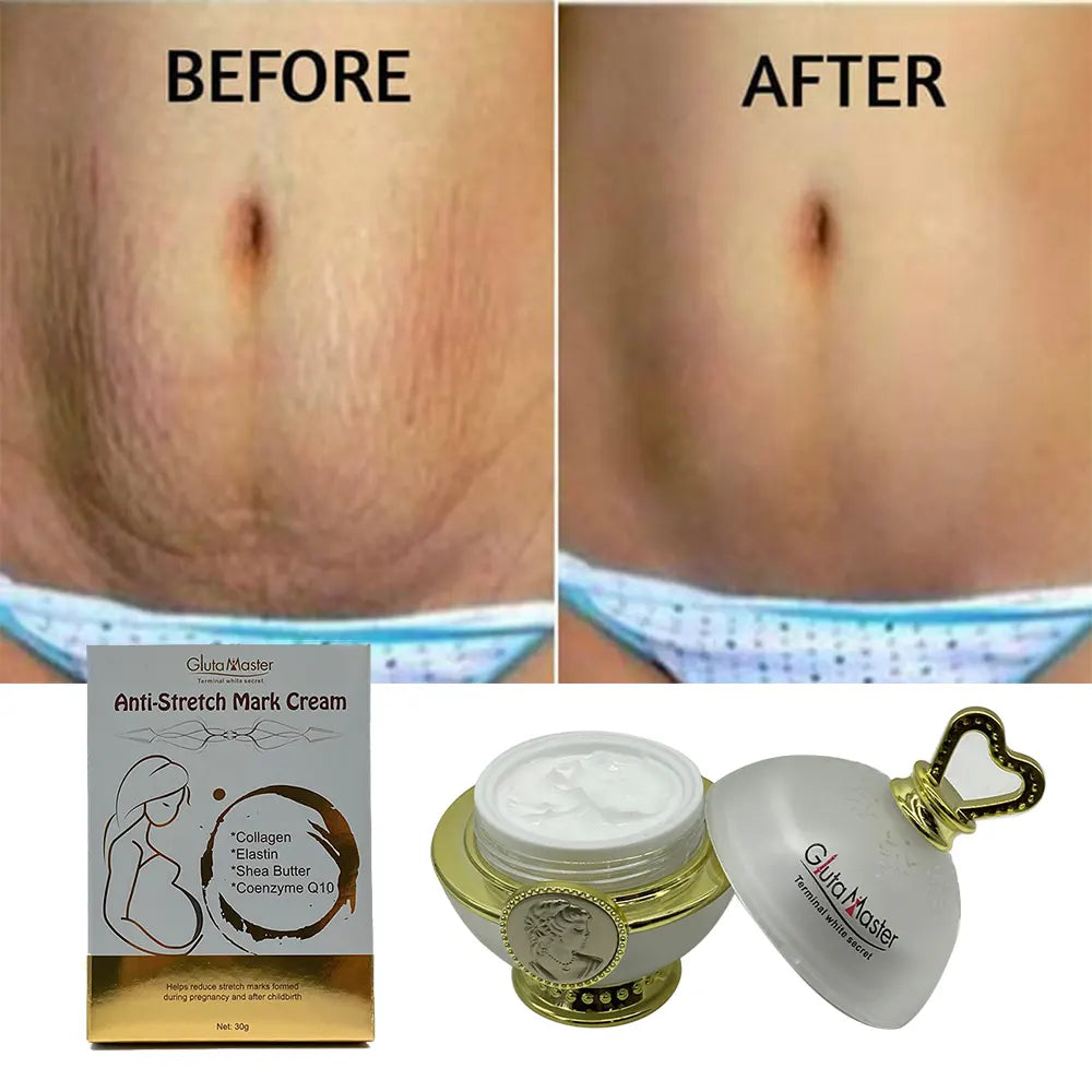 Gluta Master Anti Stretch Marks Cream With Collagen / Shea Butter