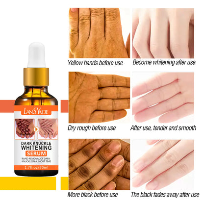 LansYade Dark Knuckle Whitening Serum (50ml)