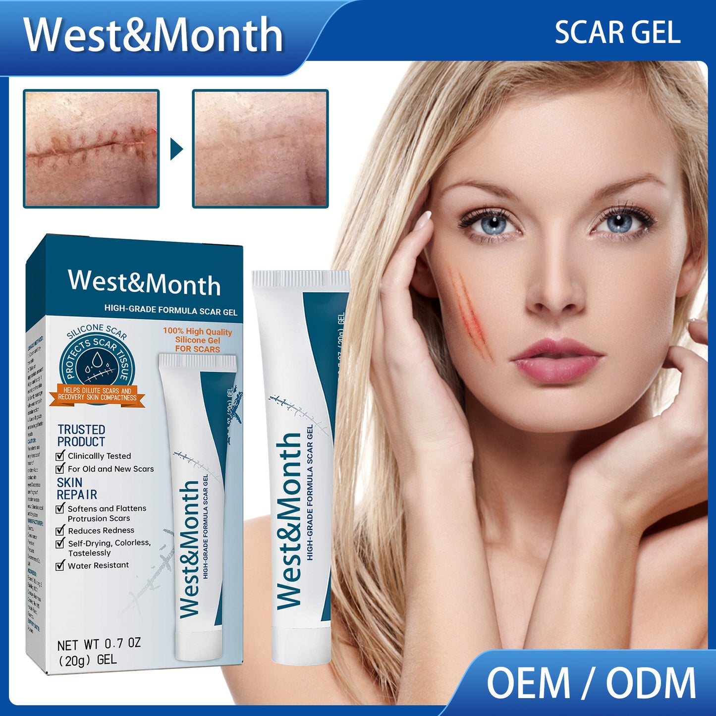 West & Month High Grade Formula Scar Gel