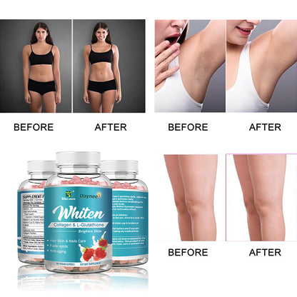 🔥 LIMITED DEAL — Daynee Whiten Collagen & L-Glutathione Gummies | Brightens Skin + Fades Dark Spots + Boosts Collagen | KSh 2,999