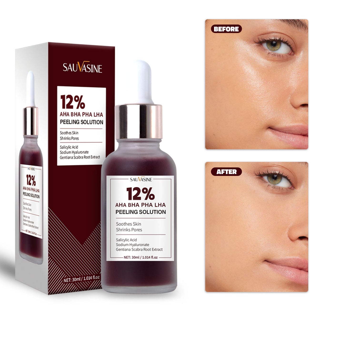 Sauvasine 12% AHA BHA PHA LHA Peeling Solution