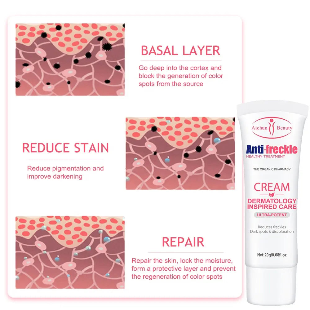 Aichun Beauty Anti-Freckle Cream