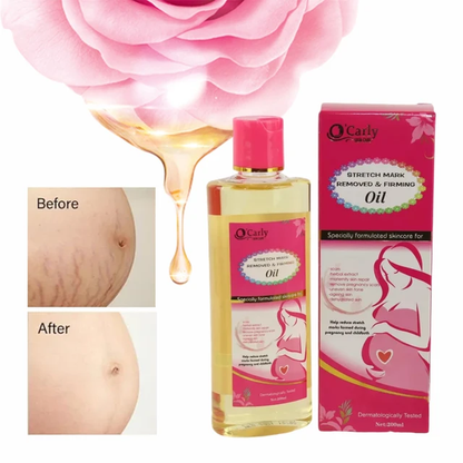 O'carly Stretch marks removal and skin firming oil