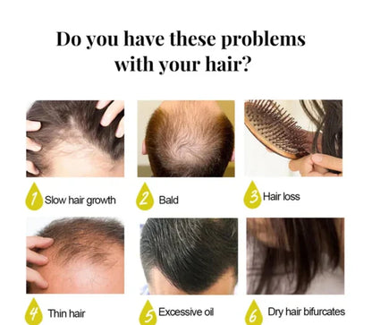 🔥 BUY 1 GET 1 FREE — King of Ginger 7-Day Hair Growth Oil | Stop Breakage + Regrow Hair | KSh 1,800
