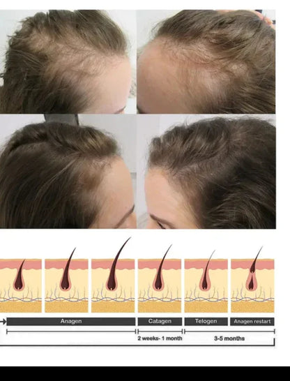 🔥 ORDER 1, WE SEND 2 — KING OF GINGER 7-Day Hair Growth Oil | Stimulates Growth + Anti-Breakage + Hair Loss Treatment | KSh 1,800