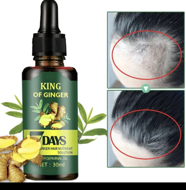 KING OF GINGER 7 days ginger hair growth stimulator, anti-breakage and hair loss treatment oil organic germinal serum