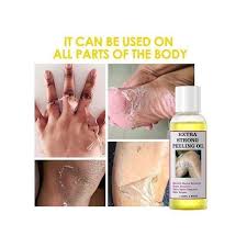 🔥 LIMITED DEAL — O'Carly Extra Strong Peeling Oil | Deep Exfoliation + Dark Spot Fading + Radiant Glow | KSh 1,800